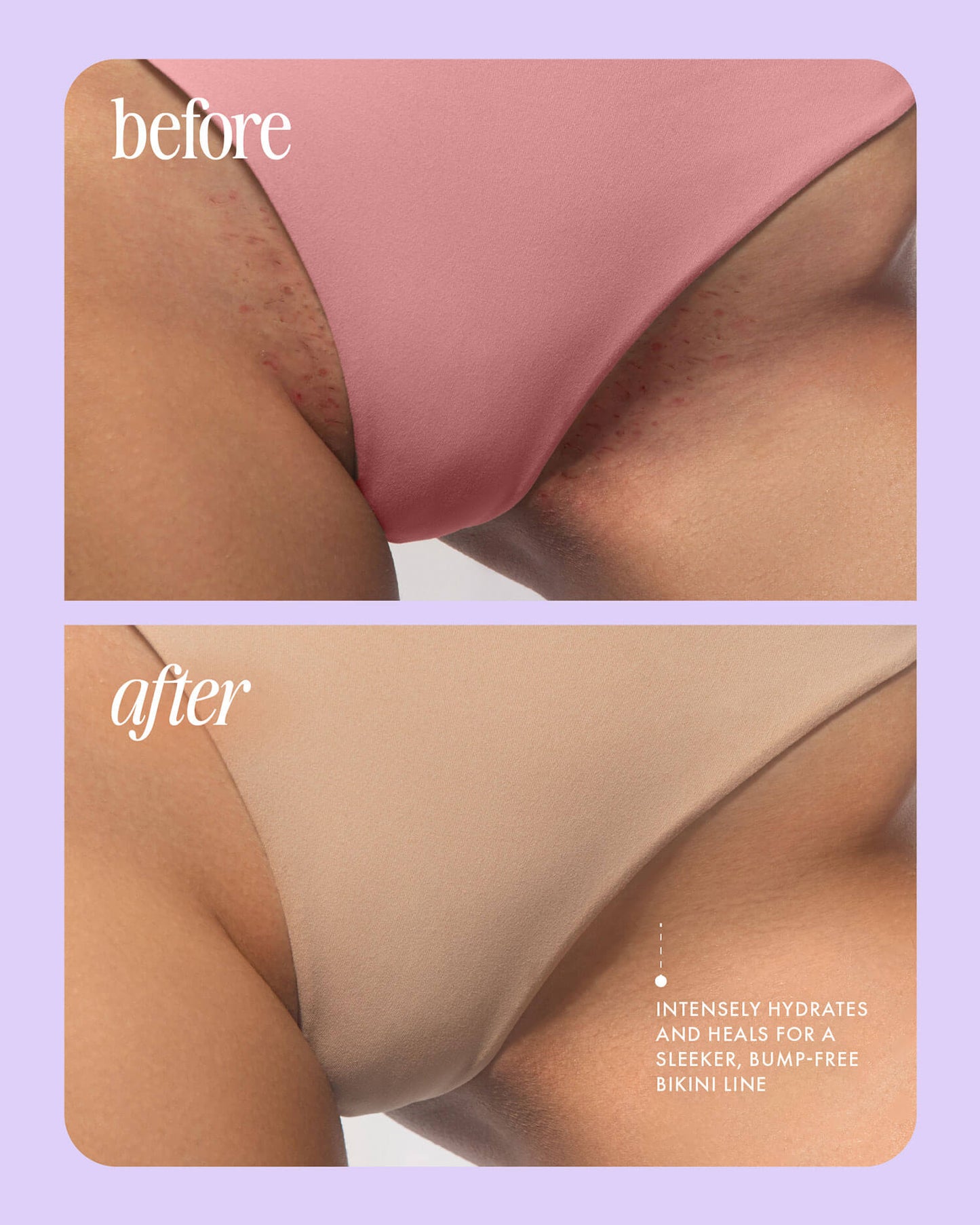 Wozevy® Serum Post-Depilación